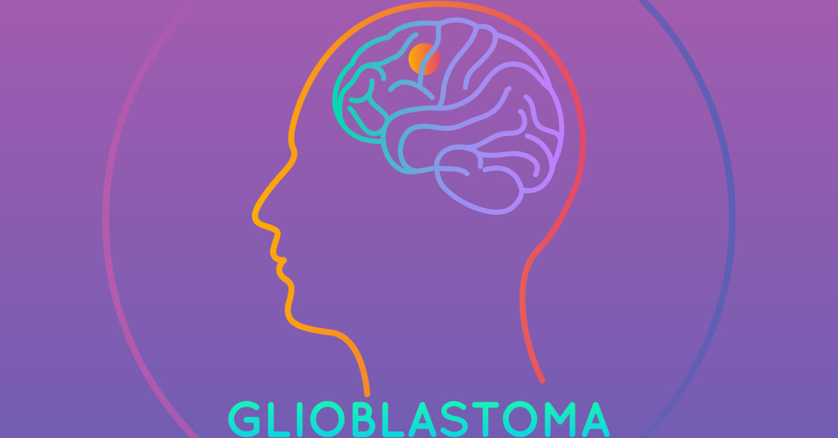 Breakthrough in use of precision cancer medicines for Glioblastoma