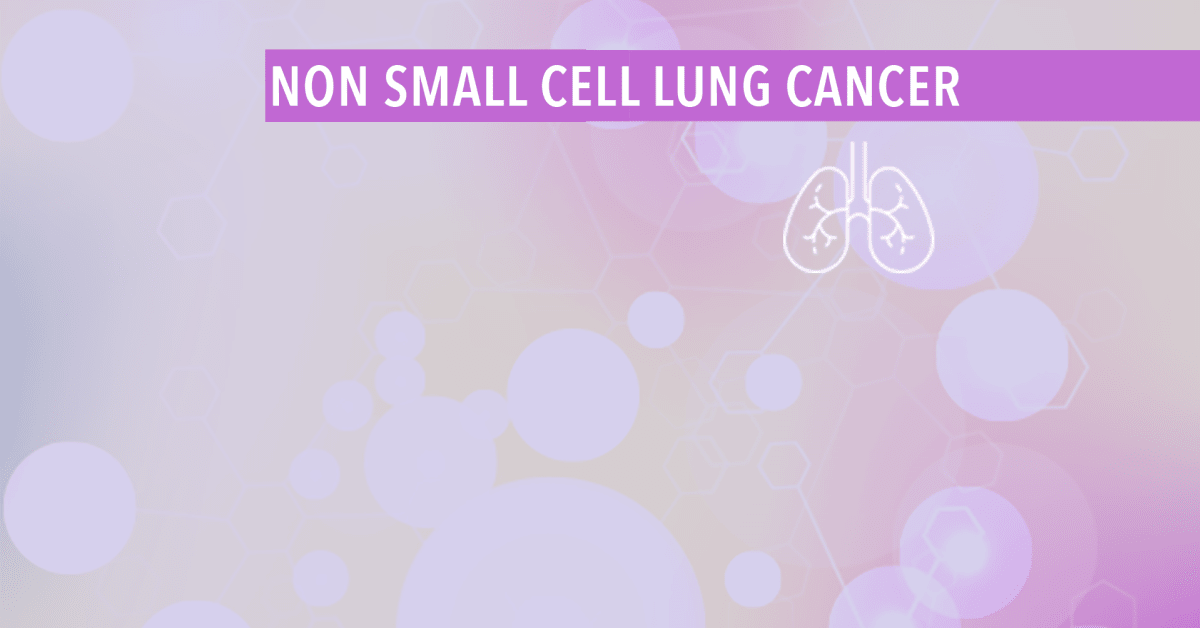 Treatment Of Stage I - IIIA Non-Small Cell Lung Cancer - CancerConnect