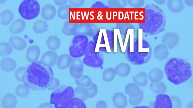 AML News & Updates