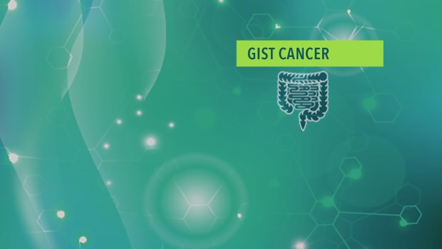 Gastrointestinal Stromal Tumors GIST