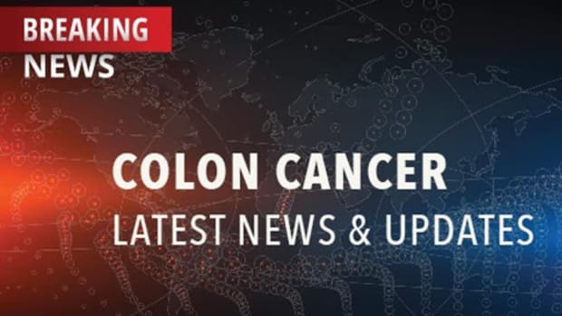 Radiation Therapy for Colon Cancer - CancerConnect