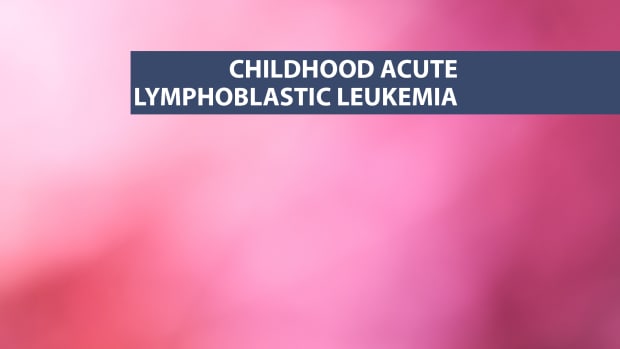 Childhood Acute Lymphoblastic Leukemia ALL