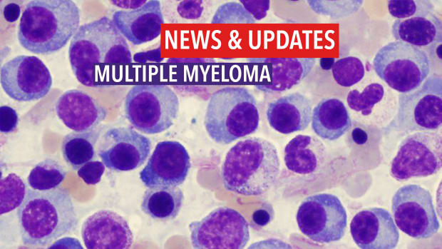 Multiple Myeloma News Updates