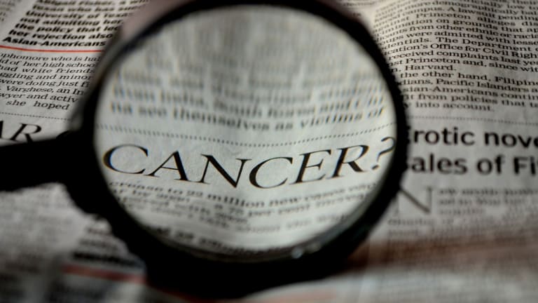 Cancer surging among people under 50 worldwide: Study