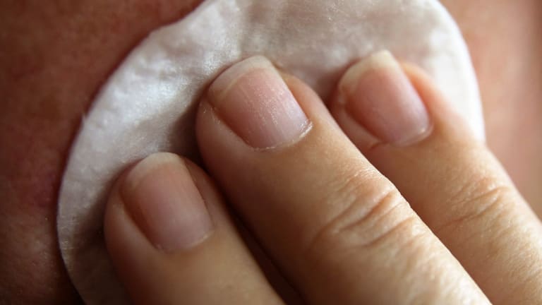 Close-up of Thumb and Nail with Dry Skin, Torn and Flaking Off Stock Image  - Image of cosmetic, fingernail: 255737475