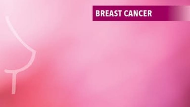 Pilates and Breast Cancer