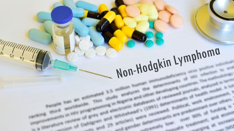 Treatment of DLBCL and Aggressive Non Hodgkins Lymphoma