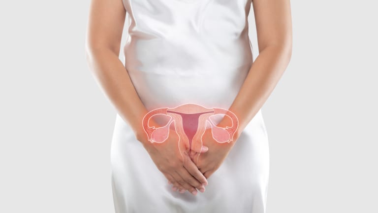 Treatment of Stage II Cervical Cancer
