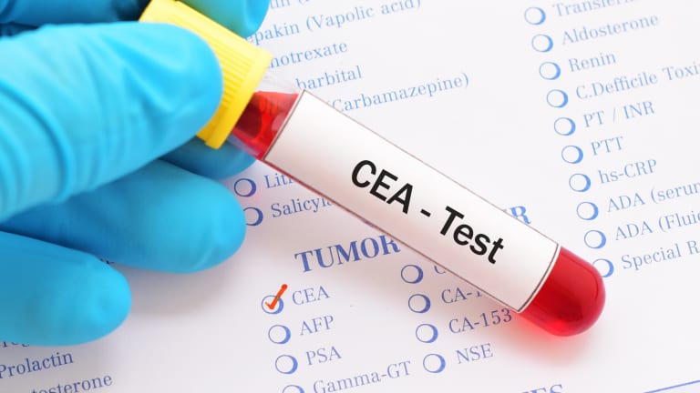 Understanding The CEA Test in Colon and Gastric Cancer