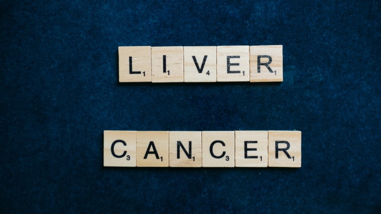 Overview of Liver Cancers