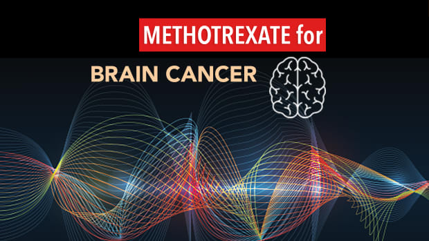 Methotrexate Brain Cancer