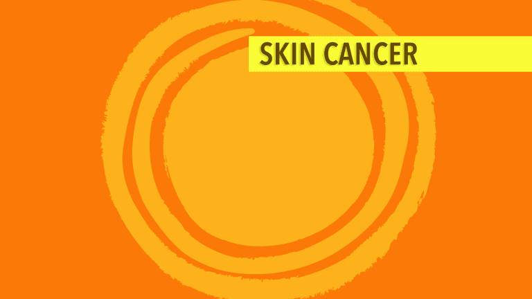 Treatment & Management of Skin Cancers