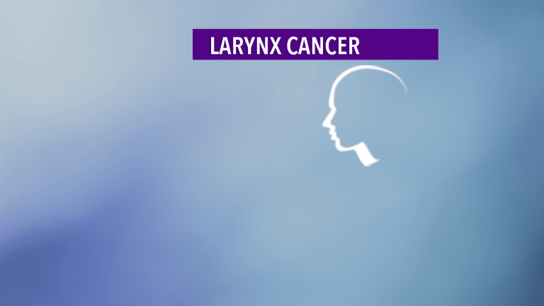 Overview of Larynx Cancer