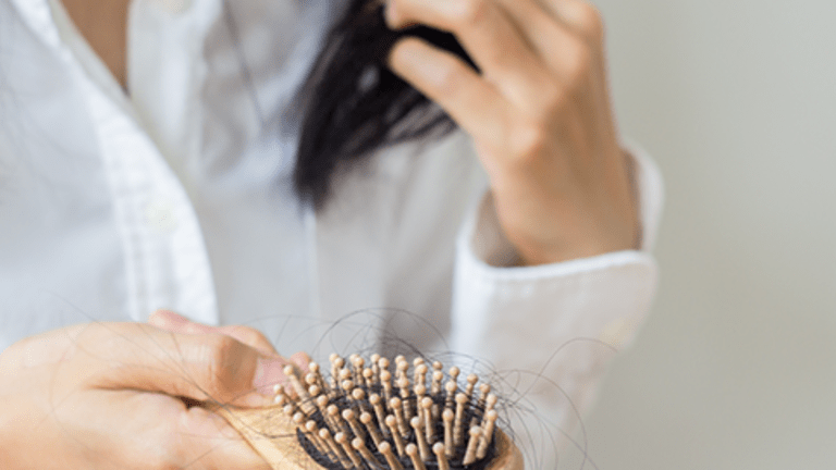 Side Effect of Treatment: Hair Loss