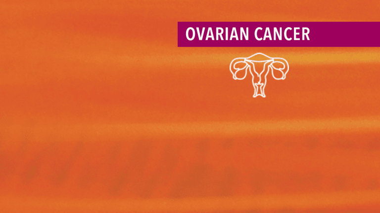 Treatment & Management of Ovarian Cancer