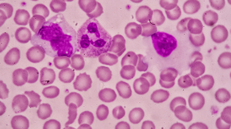 Chemotherapy Induced Neutropenia Increases the Risk of Infection