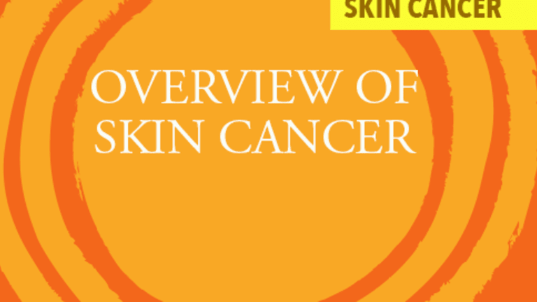 Overview of Skin Cancer