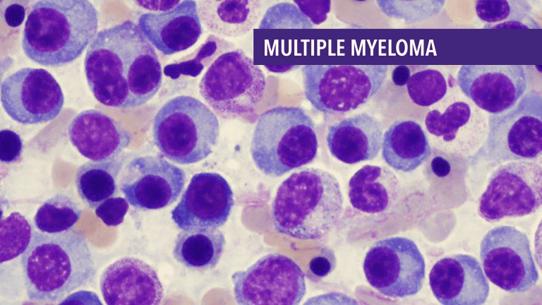 Supportive Care for Multiple Myeloma