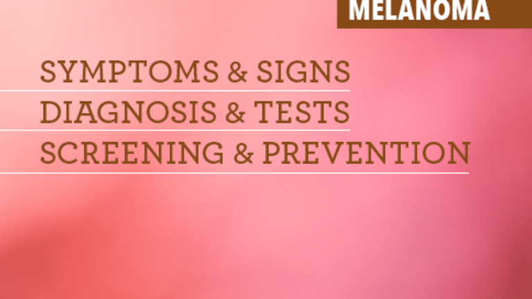 Overview of Melanoma