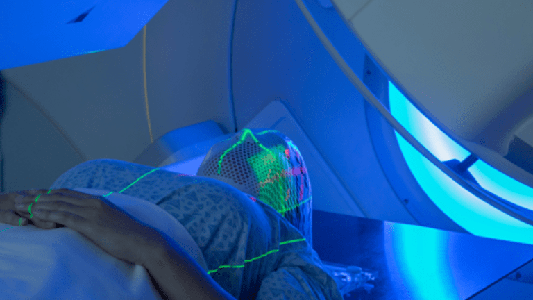 Radiation Therapy for Treatment of Cancer