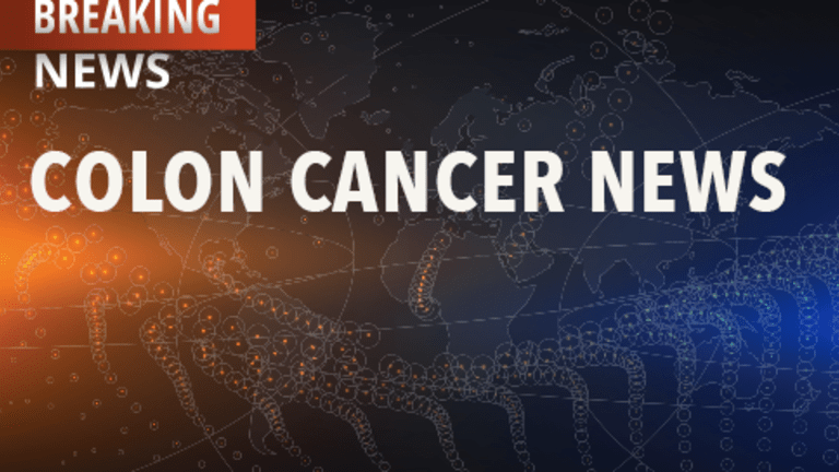 Completing Chemotherapy for Colorectal Cancer: Benefits and Challenges