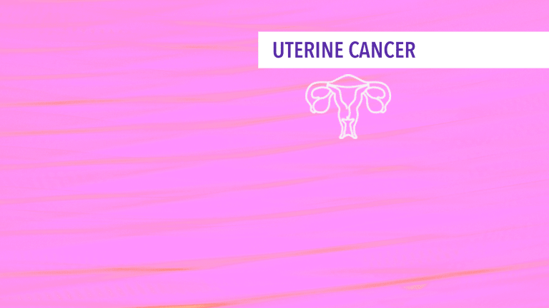 Treatment of Stages I - II Uterine Cancer