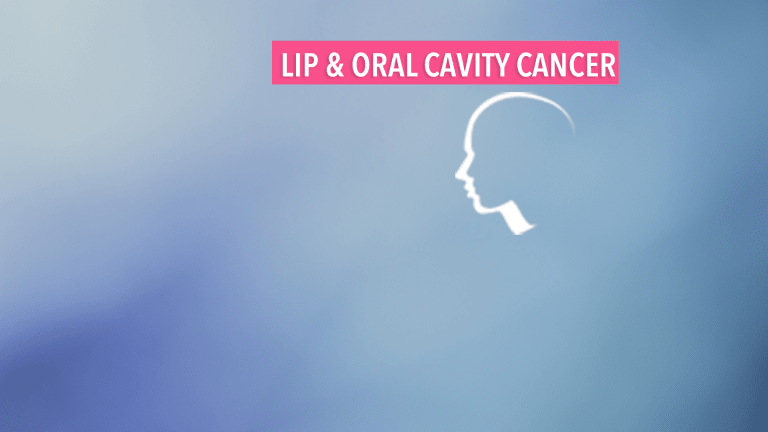 Overview of Lip & Oral Cavity Cancer