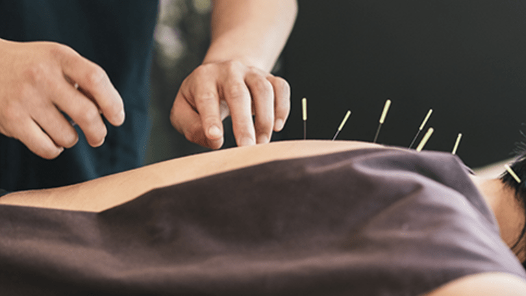 Complementary Therapies in Cancer Care Acupuncture