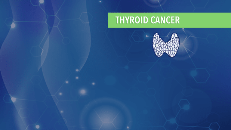Precision Cancer Medicine Treatment of Thyroid Cancers