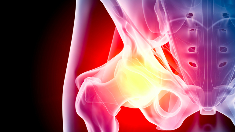 Bone Pain is a Common Side Effect of Cancer & It's Treatment