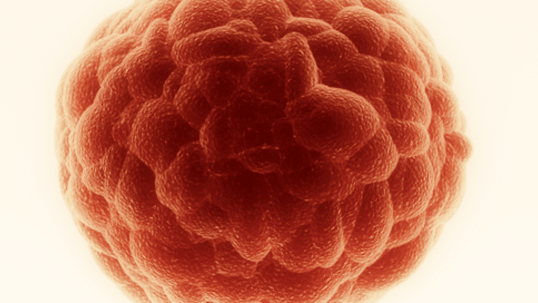 Understanding Stem Cell Transplants for Multiple Myeloma