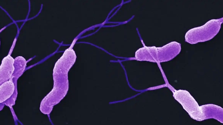 Helicobacter Pylori Infection and Gastric Cancer - CancerConnect