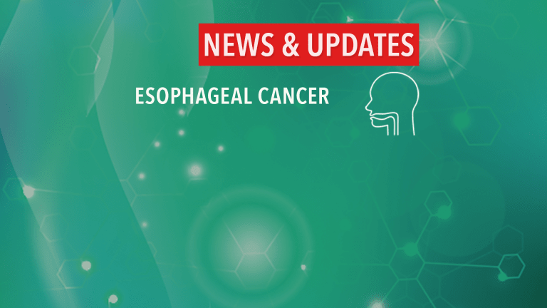 Treatment For Localized Esophageal Cancer Cancerconnect