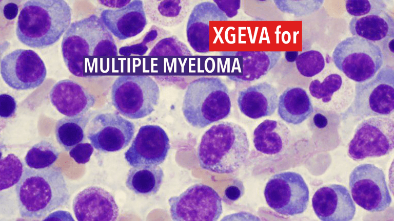 Xgeva Treatment of Multiple Myeloma Prevents Bone Complications