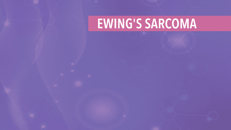 Overview of Ewing's Sarcoma