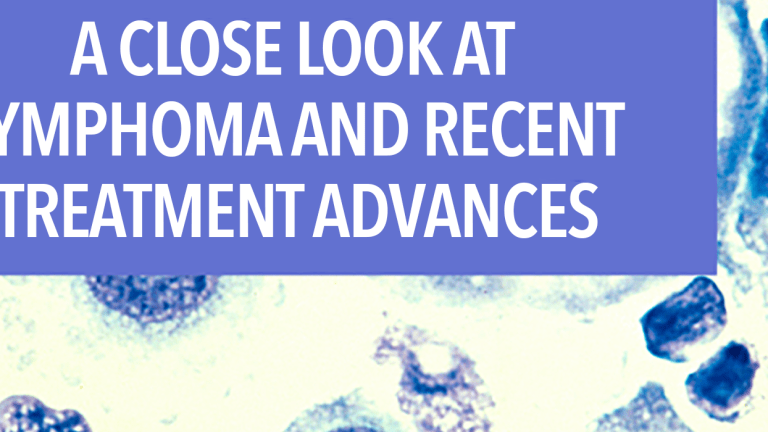 A Close Look At Lymphoma And Recent Treatment Advances Cancerconnect