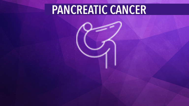 Recurrent Pancreatic Cancer