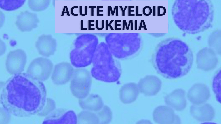 Acute Myeloid Leukemia: Overview and Treatment