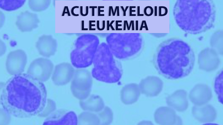 What Is Aml Leukemia In Adults