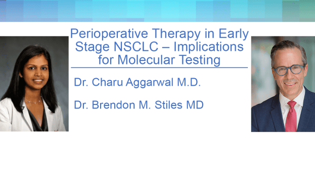 Perioperative Therapy in Early Stage NSCLC – Implications for Molecular ...