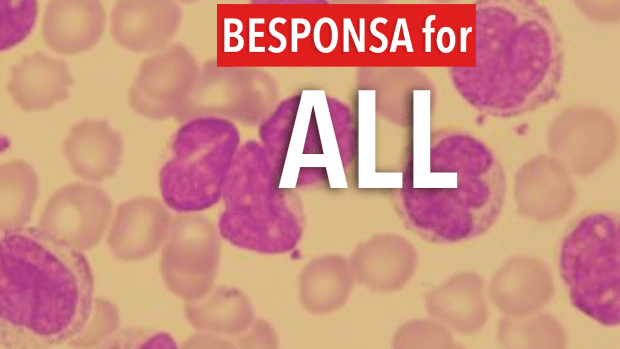 Besponsa For Refractory B- Cell Acute Lymphoblastic Leukemia ...