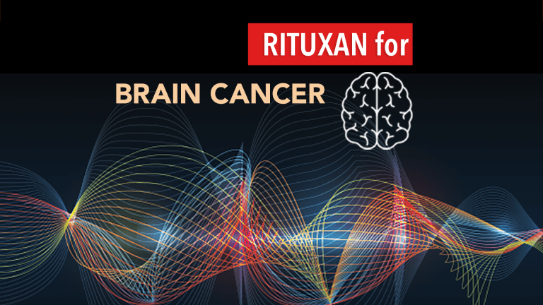 Rituxan® May Be Effective in Central Nervous System Lymphomas