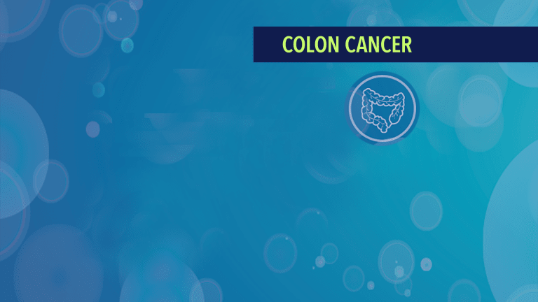 Treatment & Management of Colon Cancer