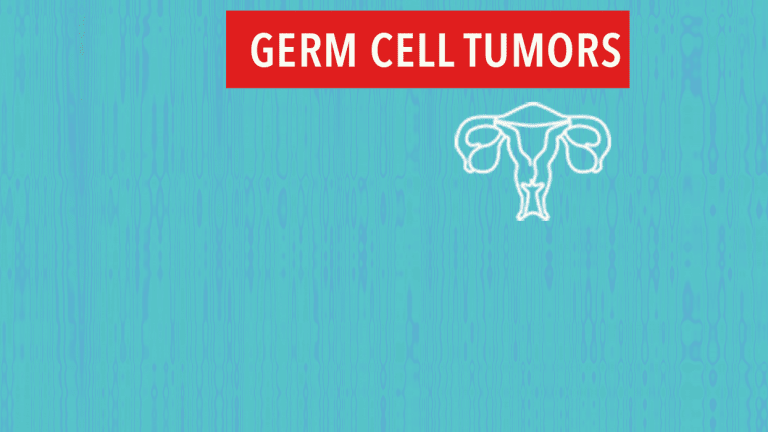 Doctors from Memorial Sloan Kettering Explain Ovarian Germ Cell Cancers