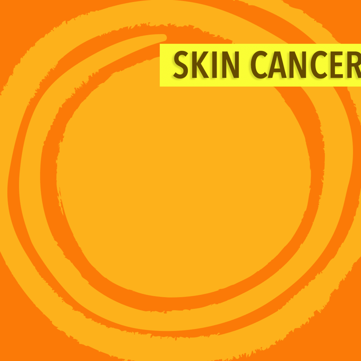 treatment management of skin cancers cancerconnect