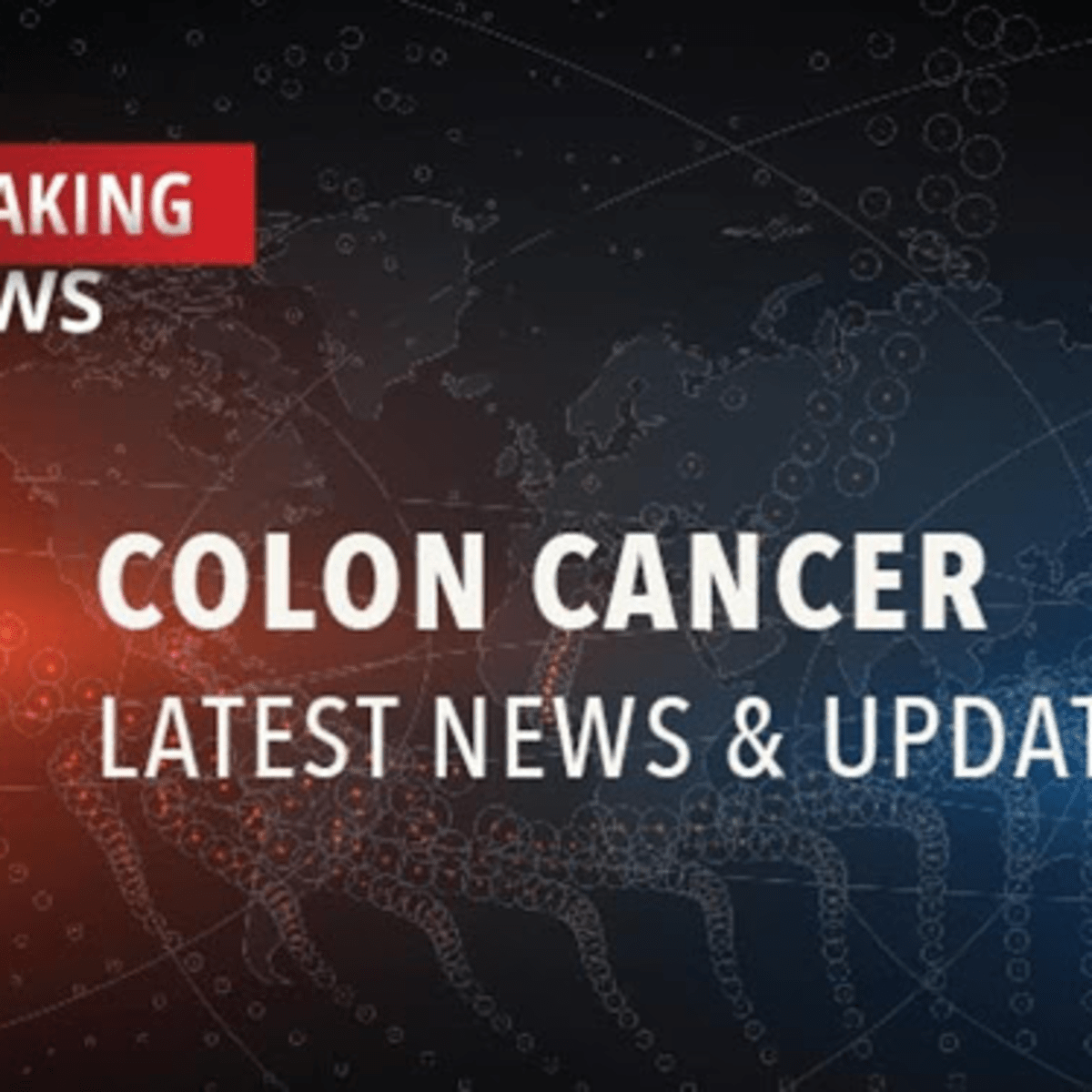 Occupational Asbestos Exposure May Be Linked With Colorectal Cancer Cancerconnect