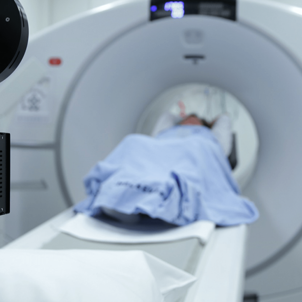 How Accurate Is a CT Scan for Lung Cancer?