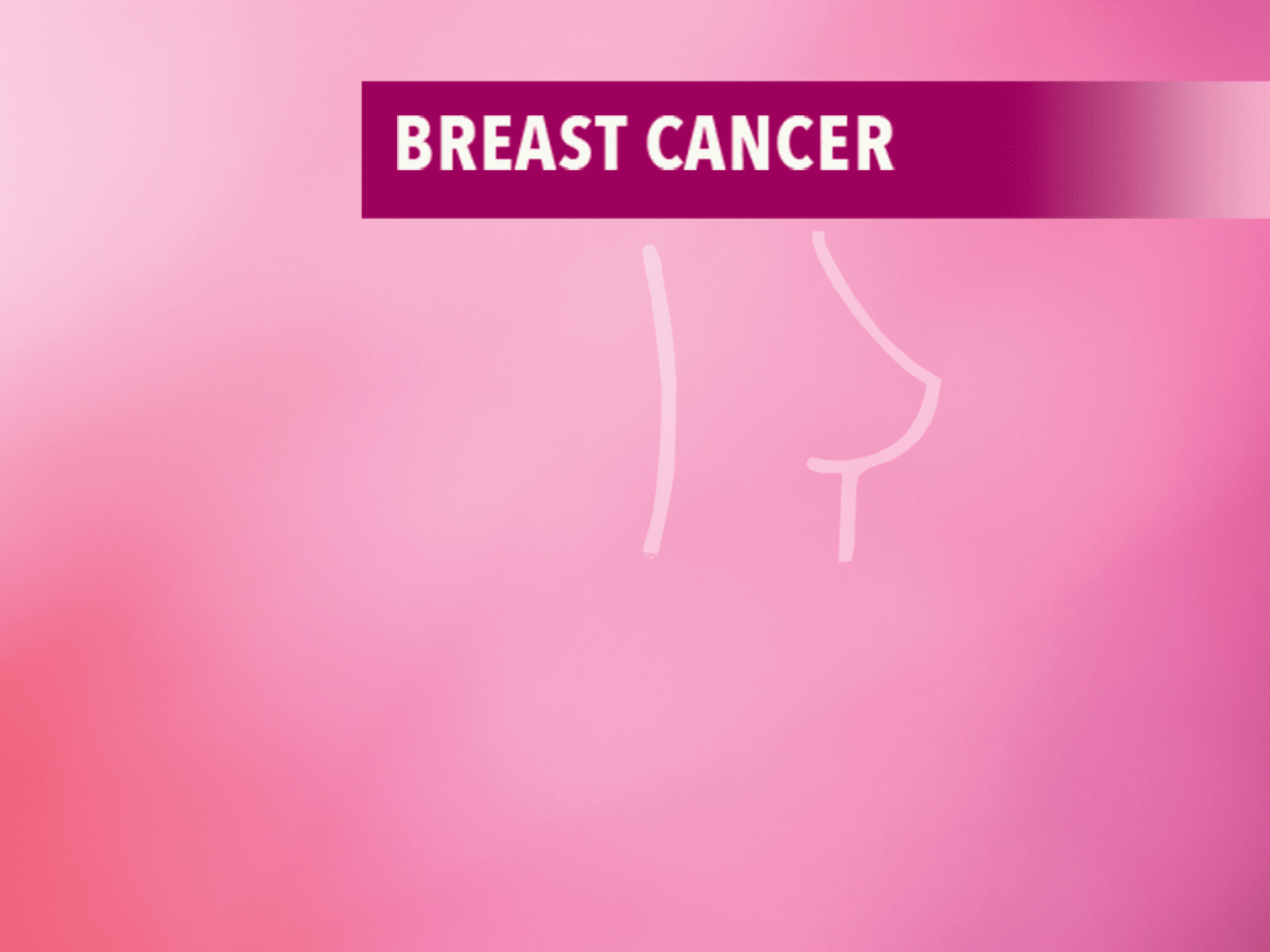 Lumpectomy for Breast Cancer: Uses, Procedure, Results