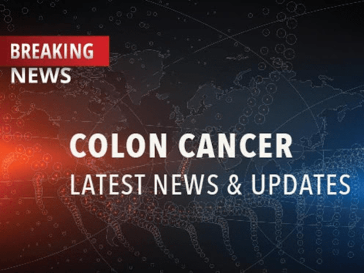 Colon cancer Information