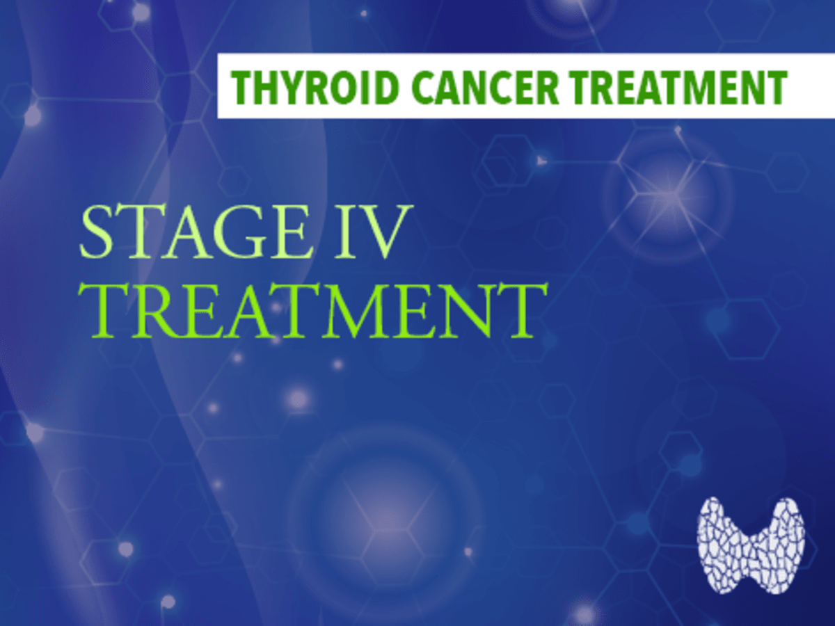 Treatment of Stage IV Thyroid Cancer - CancerConnect